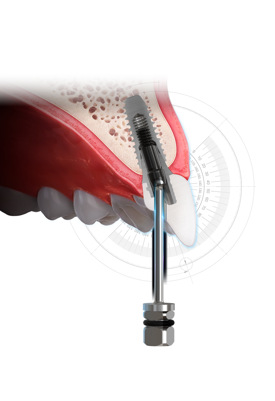 Angle torque driver