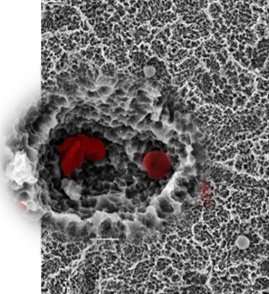 Conventional fibrin network