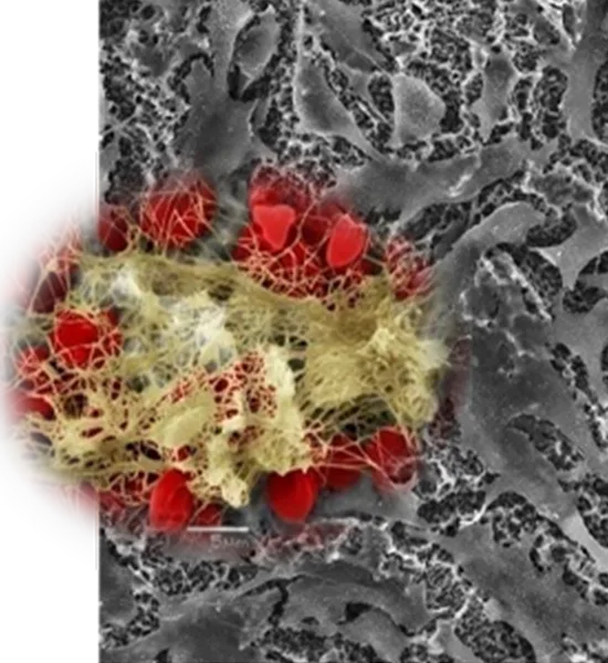 SOI fibrin network