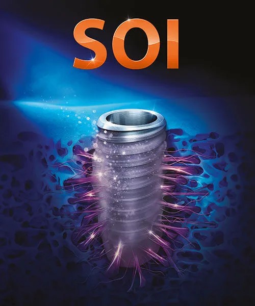 SOI surface in action