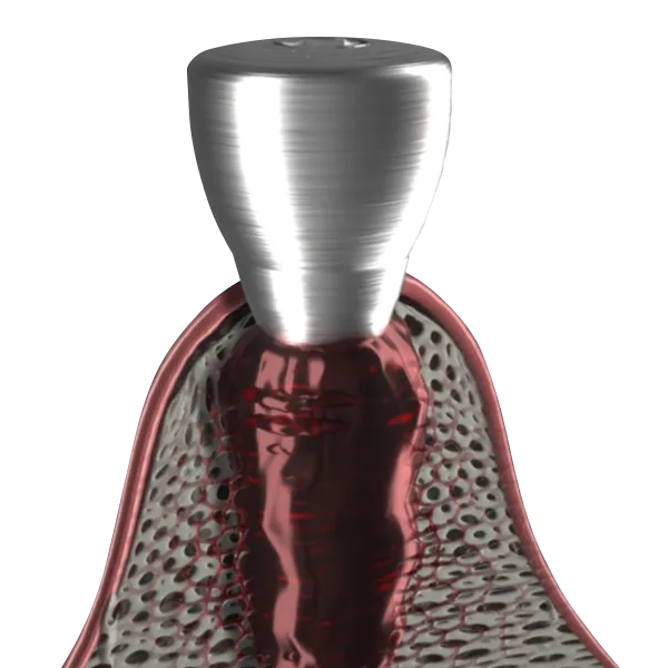 SOI ultra-hydrophilic implant surface