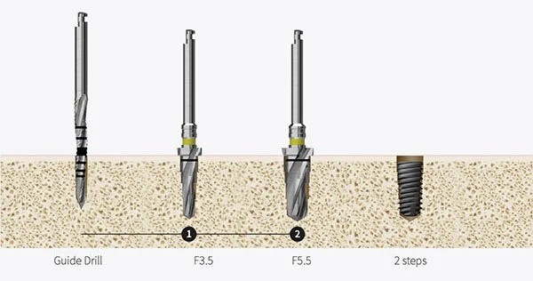 Increased user convenience — 2-step drilling
