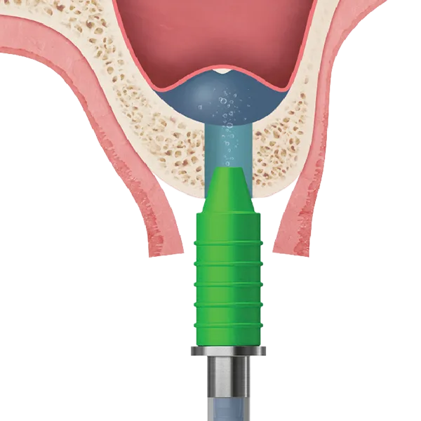 Safely lifts membrane with hydraulic pressure