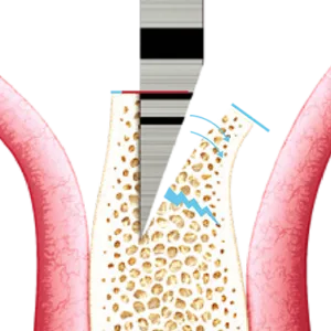 Chisel and Mallet