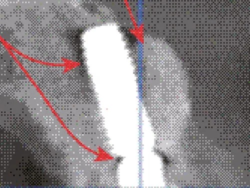 General GBR X-ray