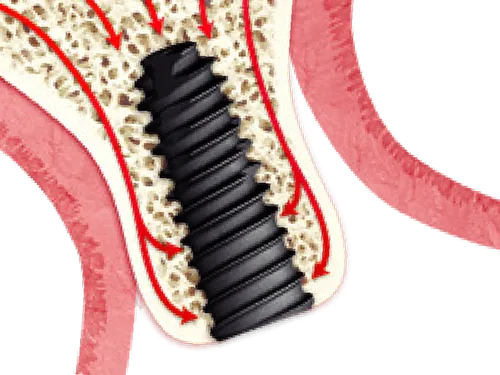 Ridge Split illustration
