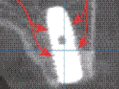 Ridge Split X-ray
