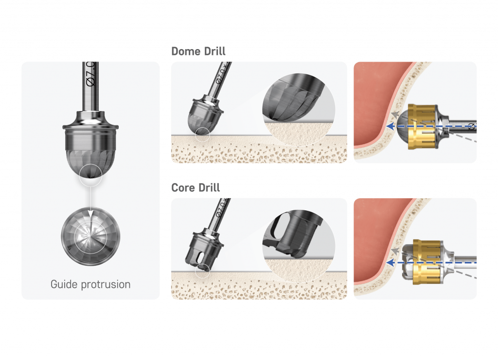 Good Accessibility and Convenient Surgery by Stable Drilling Performance